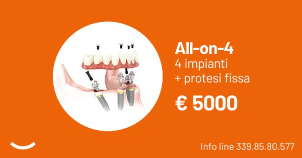 All-on-4 4 impianti + protesi fissa in ceramica 5300 eur