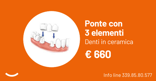 Ponte con 3 elementi - Denti in ceramica